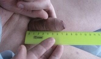 medida del tamaño del pene
